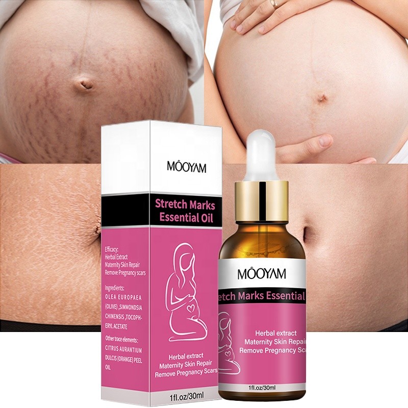 Stretch Mark Oil Factory - OEM Effective Repair Pregnancy Scar