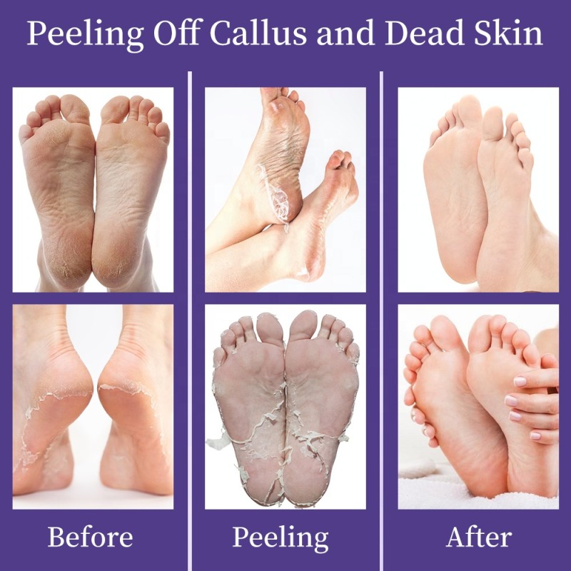 Foot Mask Manufacturer - OEM Lavender Exfoliating SPA Peeling Care