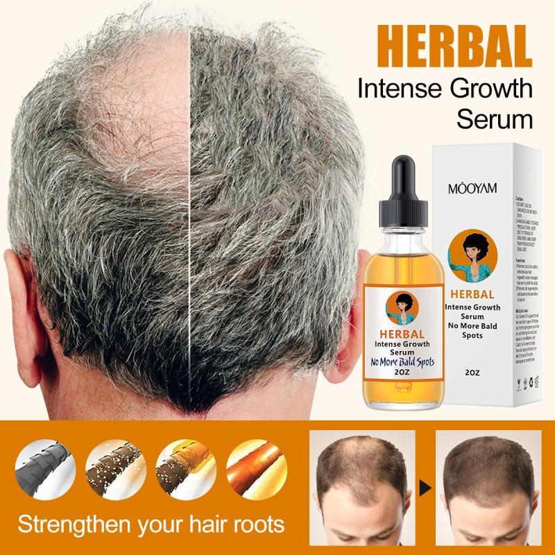 Hair Essence Supplier - OEM 30ml Natural Ginger Germinal Oil