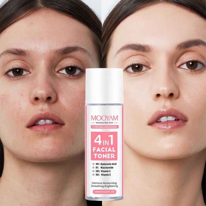 Facial Toner Supplier - OEM 4 in 1 VC Blemish Fade Hydrating
