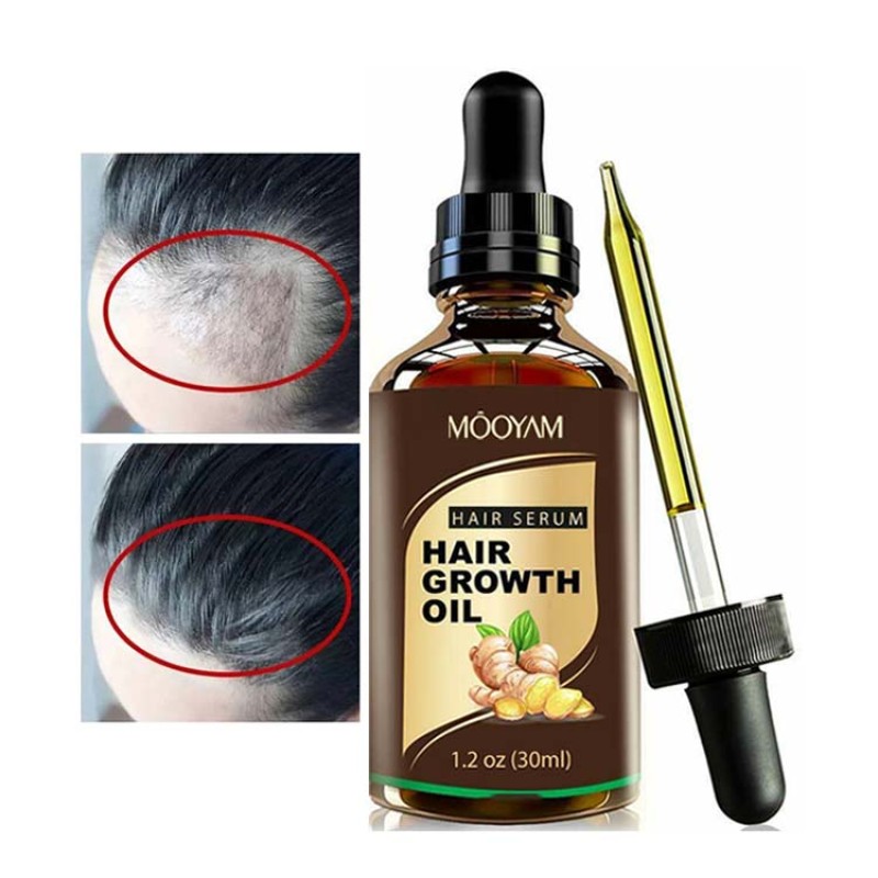 Hair Treatment Factory - OEM 30 Days Efficient Restore Growth