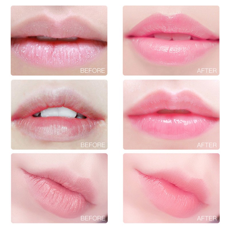 Lip Patch Manufacturer - OEM Organic Golden Hydrating Collagen Lip