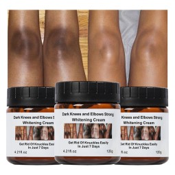Whitening Cream Supplier - OEM Instant Strong Dark Knees Elbows