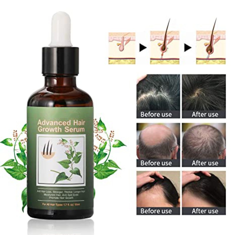 Hair Serum Manufacturer - OEM ISO Health Care Dense Growth Serum