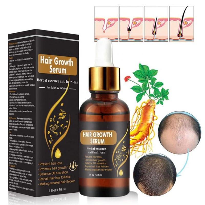 Hair Serum Supplier - OEM Repair Stops Loss Promotes Thicker
