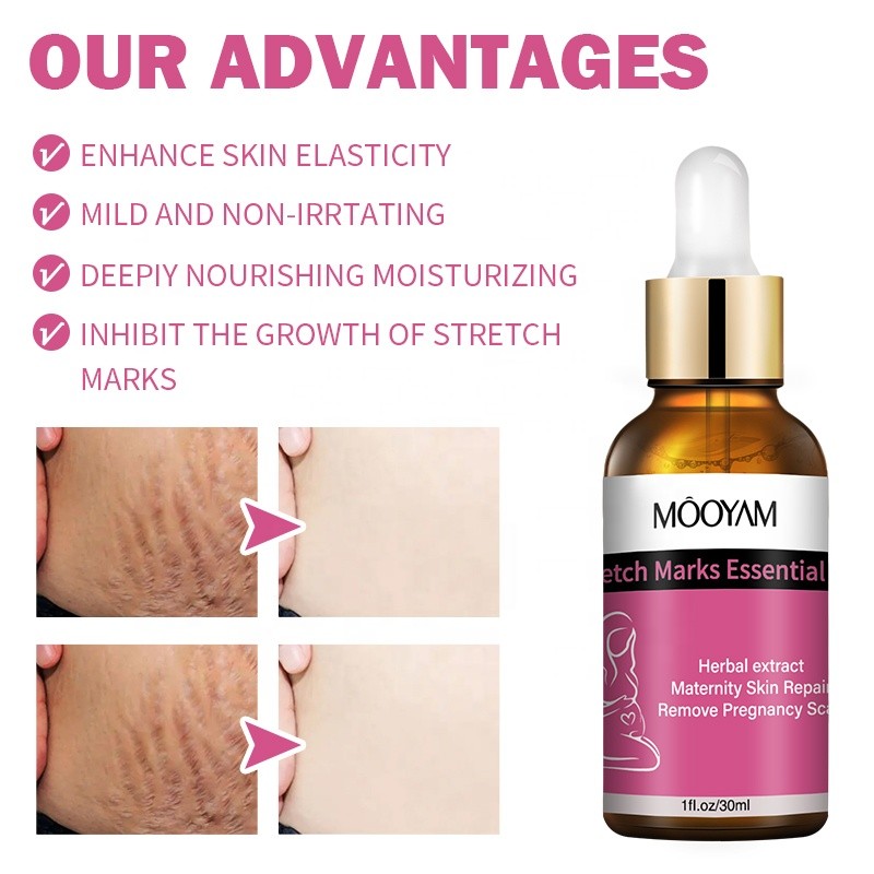 Stretch Mark Oil Factory - OEM Effective Repair Pregnancy Scar