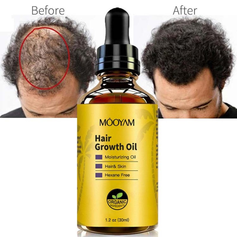 Hair Oil Manufacturer - OEM Custom Fast Growth Anti Loss Organic