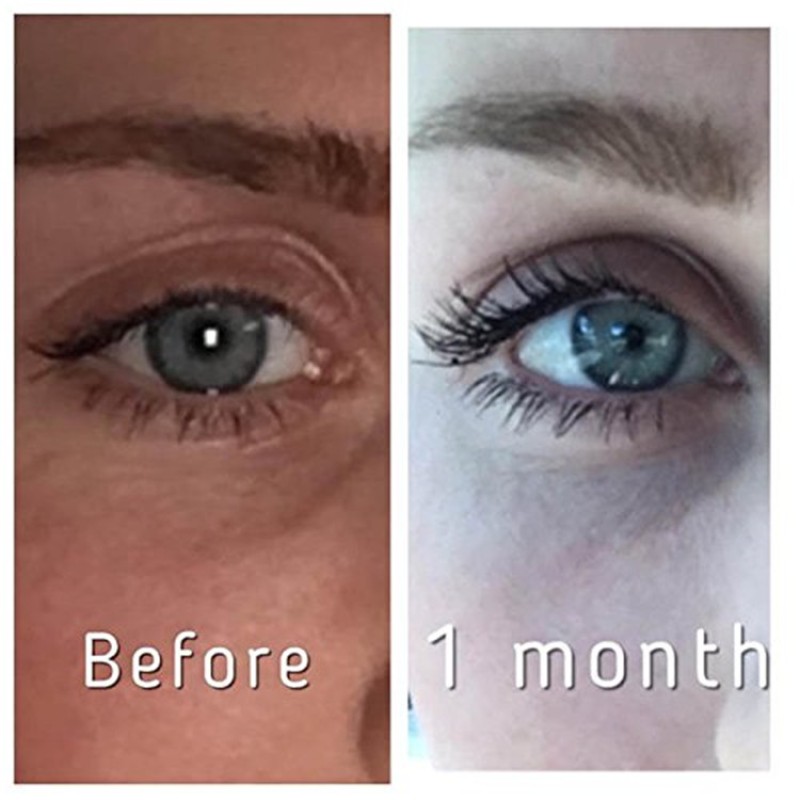 Eyelash Serum Manufacturer - OEM Natural Longer Fuller Thicker Mascara
