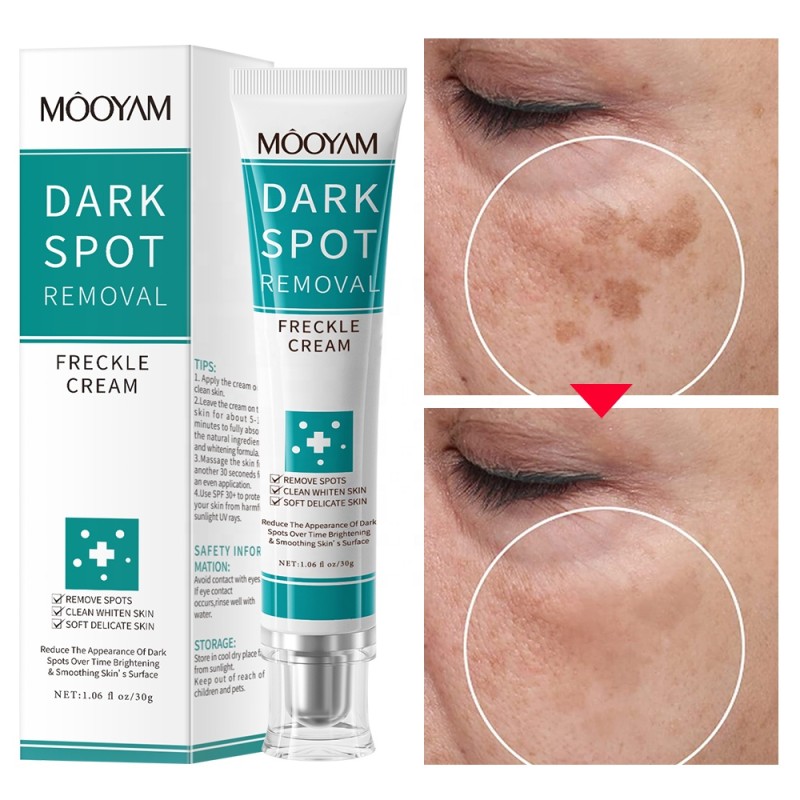 Whitening Cream Manufacturer - OEM Strong Freckle Melasma Melanin Remover