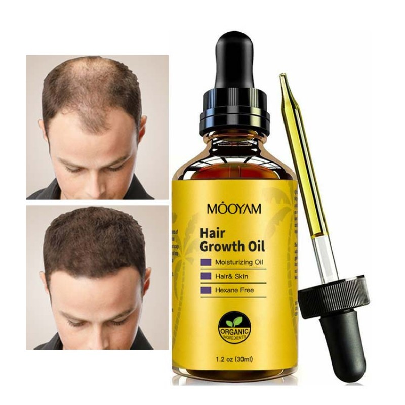 Hair Oil Manufacturer - OEM Custom Fast Growth Anti Loss Organic