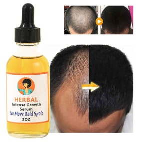 Hair Oil Factory - OEM Perfect Natural DHT Blocker Vitamins