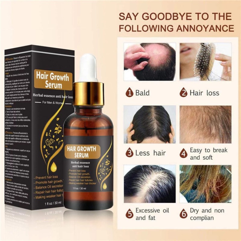Hair Serum Supplier - OEM Repair Stops Loss Promotes Thicker