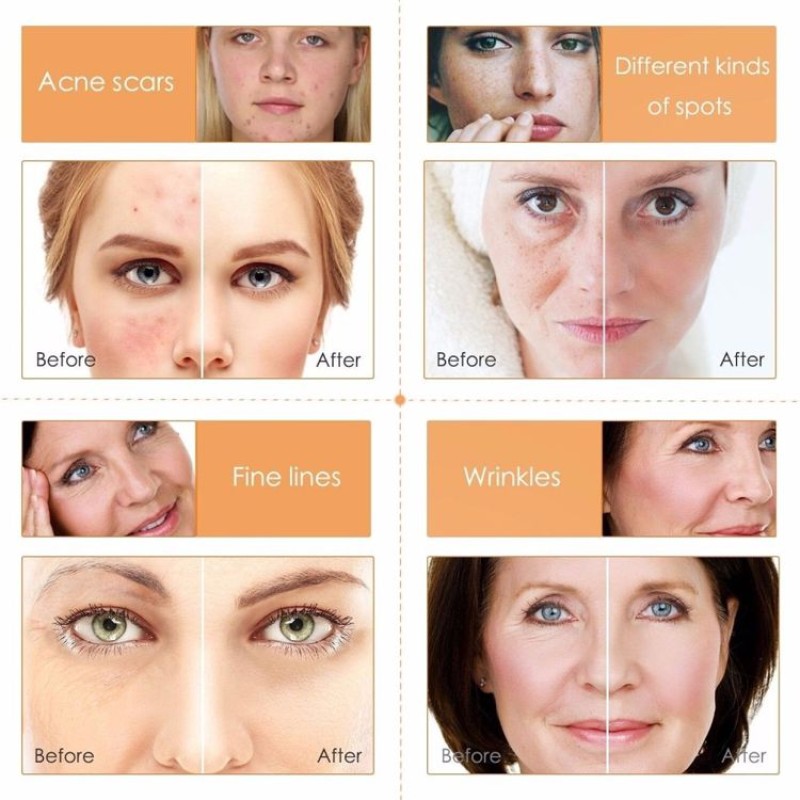 Beauty Set Manufacturer - OEM Vitamin C Anti-aging Brightening Kit