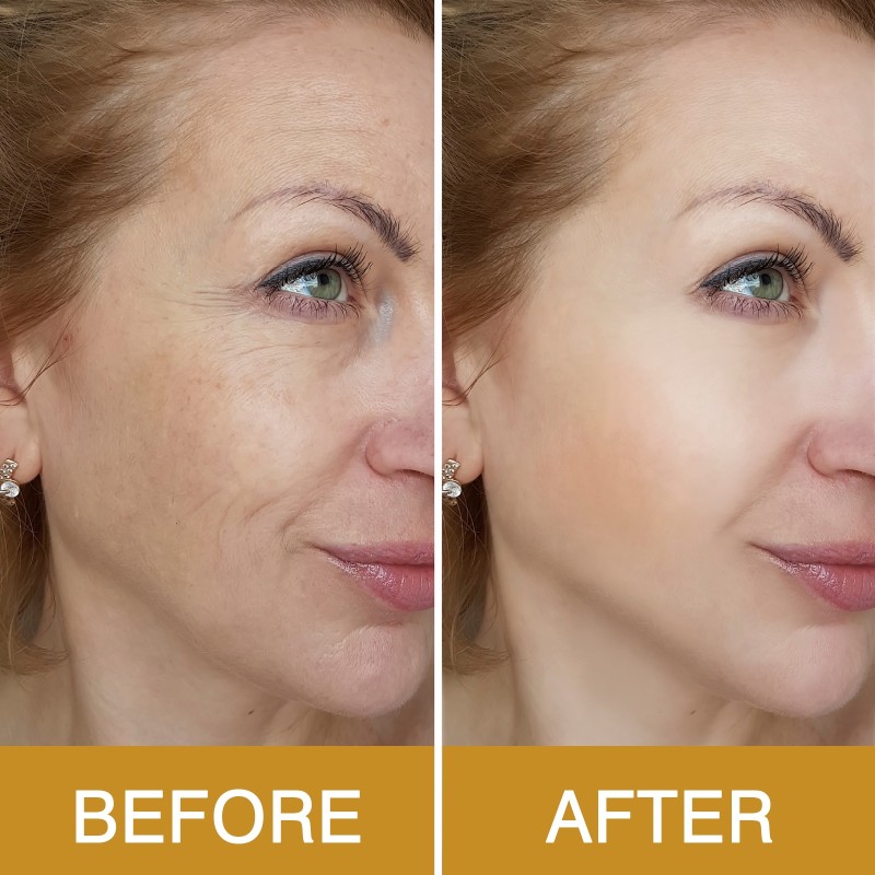 Gold Set Supplier - OEM 24K Anti-aging Wrinkle Facial Care Kit