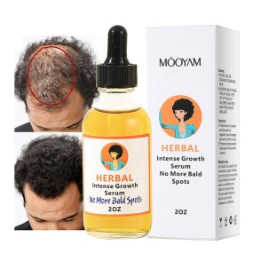 Hair Serum Supplier - OEM 30 Days Guaranty Men Hair Loss