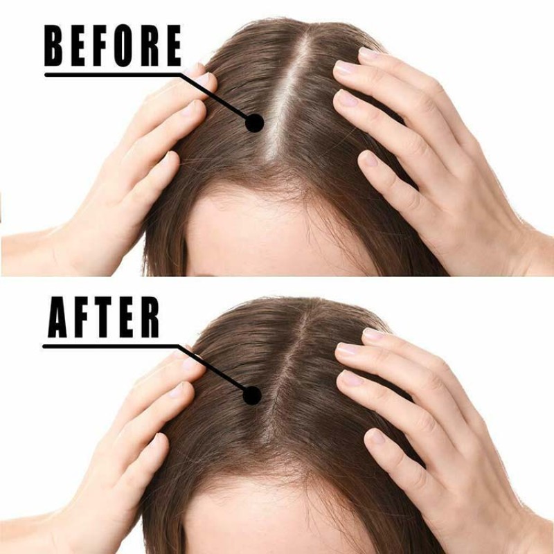 Hair Oil Manufacturer - OEM Custom Fast Growth Anti Loss Organic