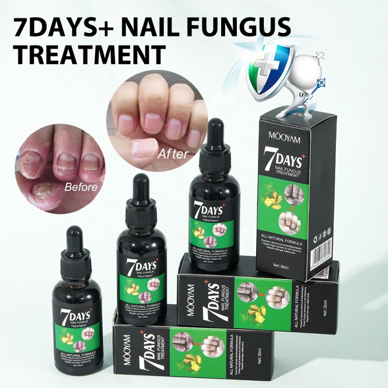 Nail Serum Manufacturer - OEM 7 Days Fungus Treatment Herbal Oil