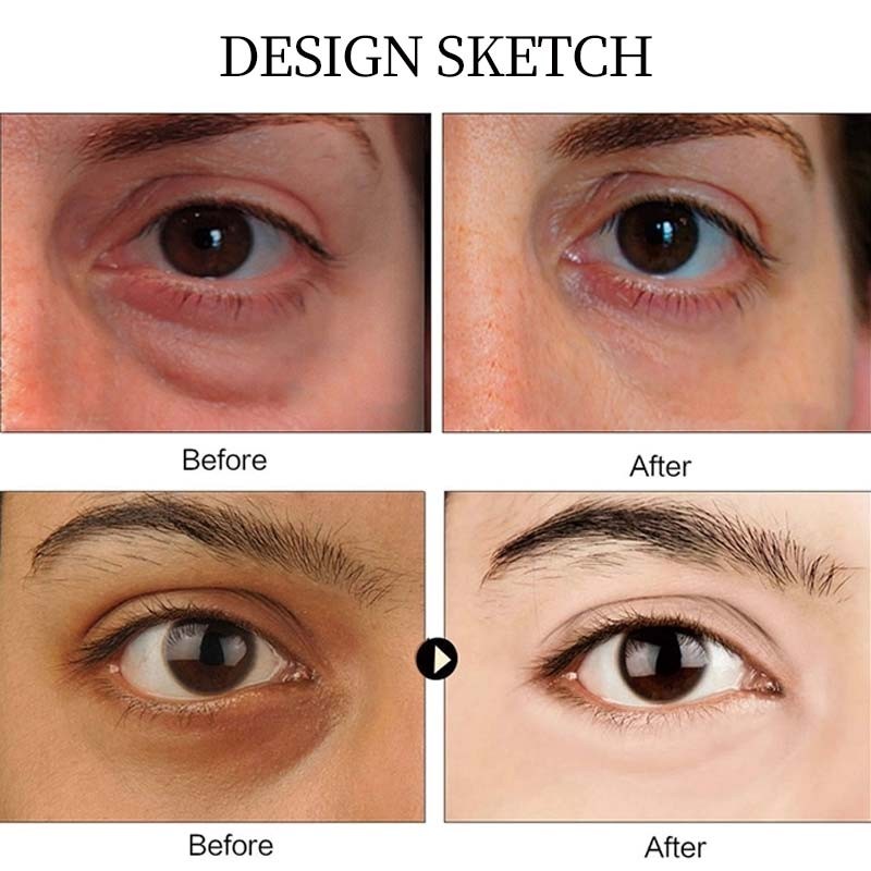 Eye Patch Manufacturer - OEM Seaweed Collagen Dark Circle Gold Mask