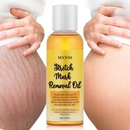 Stretch Mark Oil Supplier - OEM 100% Natural Plant Extract Scar