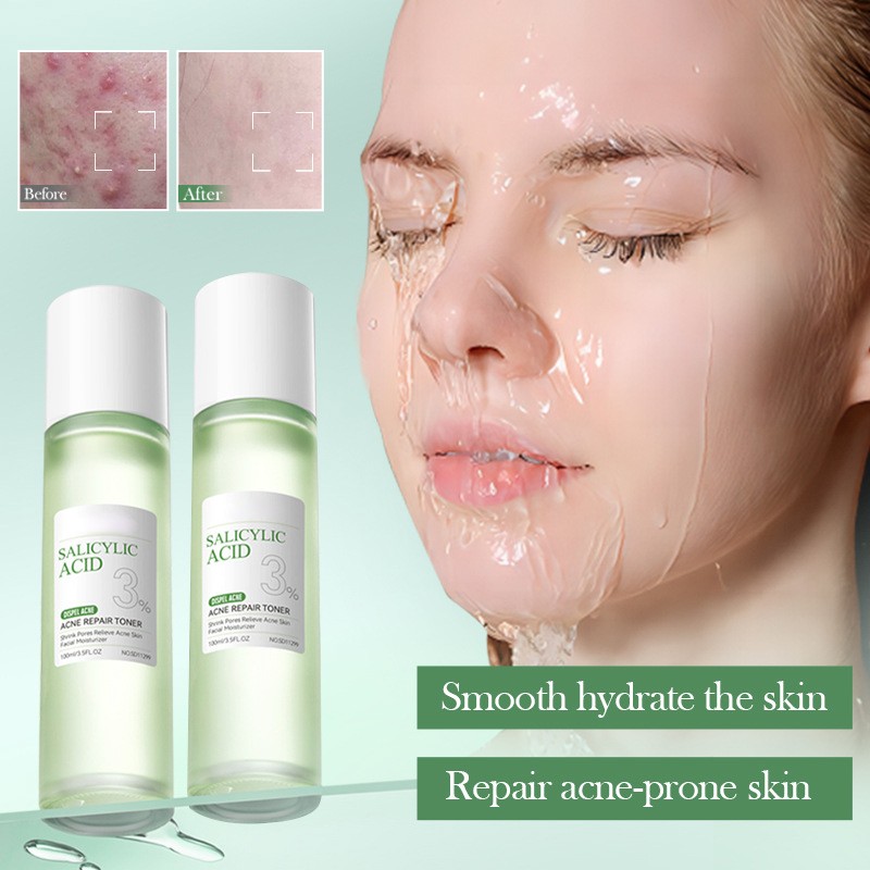Salicylic Acid Lotion Supplier - OEM Dark Spot Repair Acne Gel Moisturizing