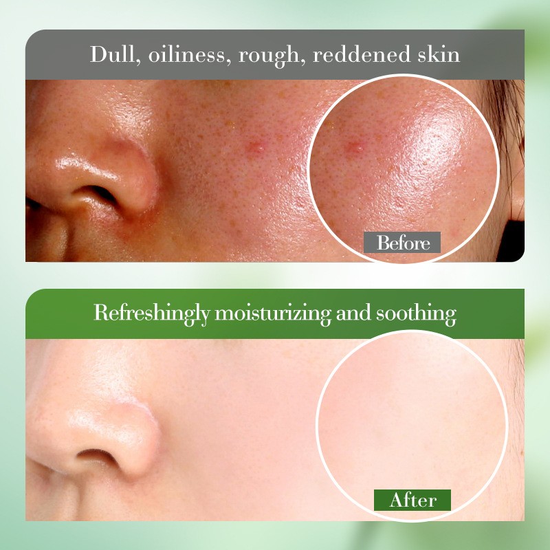 Aloe Toner Manufacturer - OEM ODM Soothing Facial Toner Moisturizing