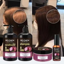 Shampoo Set Supplier - 100% Pure Natural Organic Onion Hair Growth Keratin