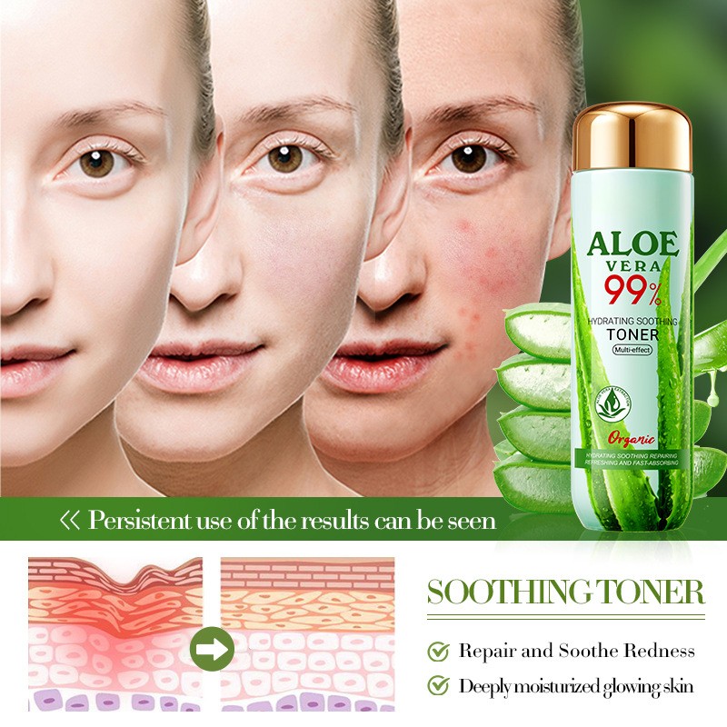 Aloe Toner Manufacturer - OEM ODM Soothing Facial Toner Moisturizing