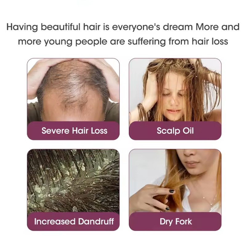 Shampoo Set Supplier - 100% Pure Natural Organic Onion Hair Growth Keratin