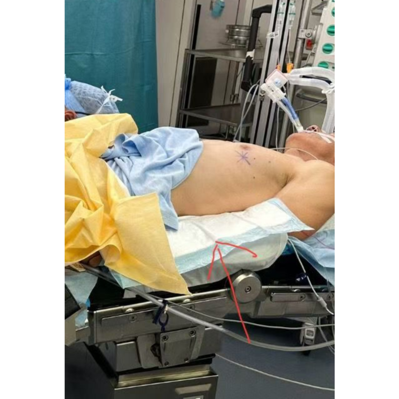 Surgical Pads Supplier - Hospital Sterile Absorbent Mats