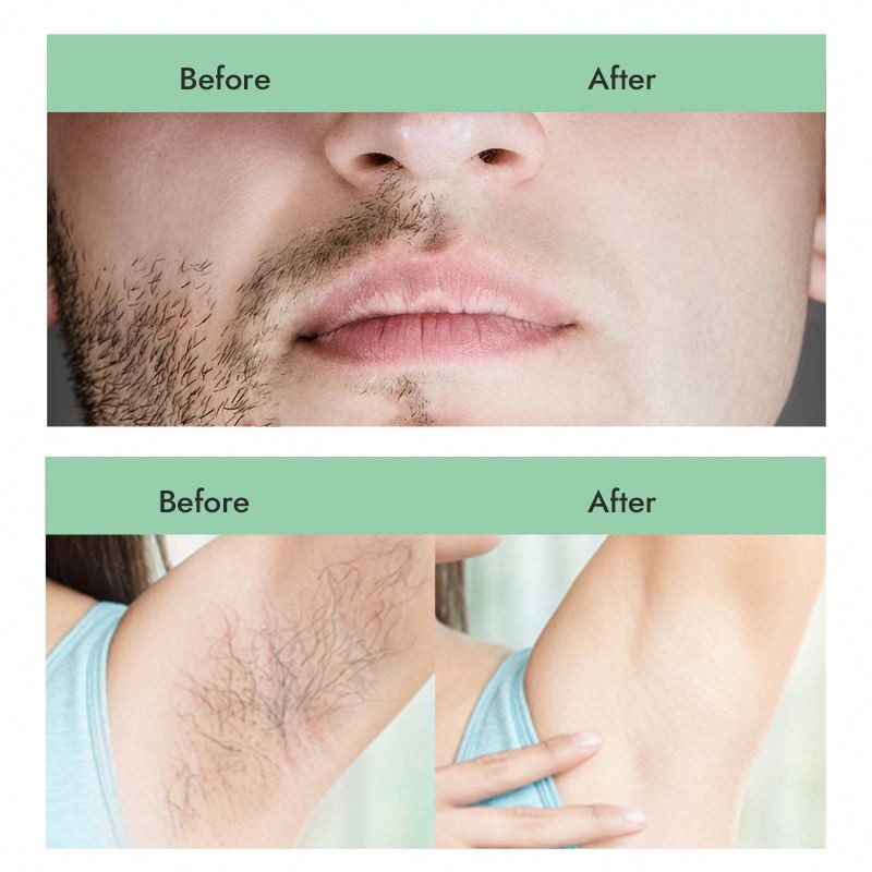 Sugar Wax Kit Factory - Hot Selling 300g Painless Microwave Use for Hair Removal