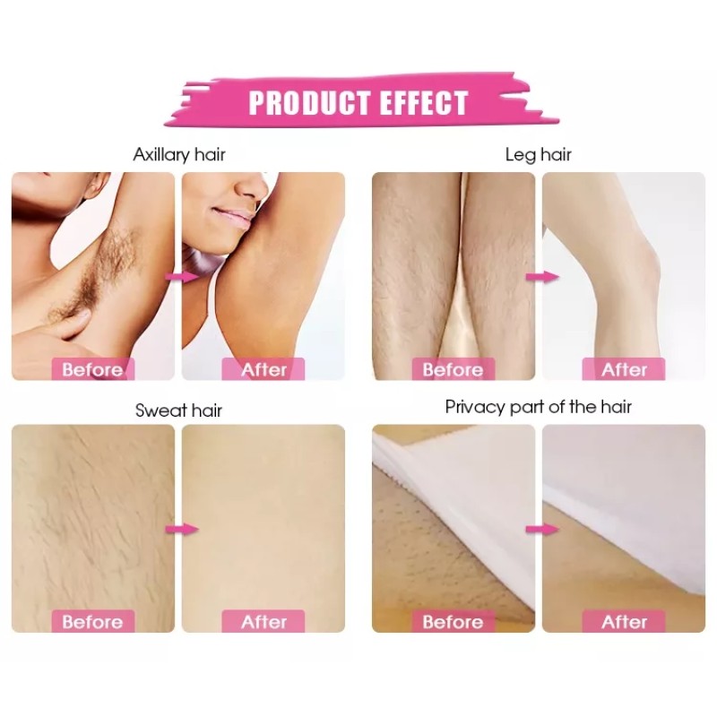 Depilatory Wax Cartridges Supplier - WAXKISS Wholesale Roll On for Hair Removal