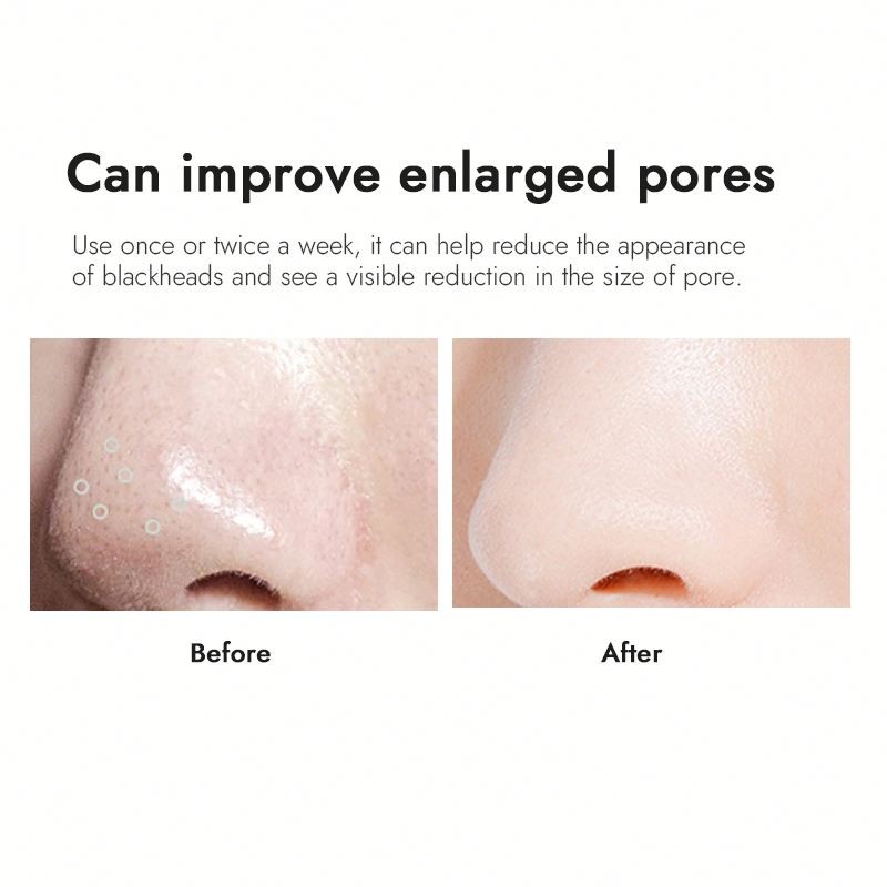 Pore Strips Manufacturer - Private Label Deep Cleansing Shrinking Patch Nose Mask