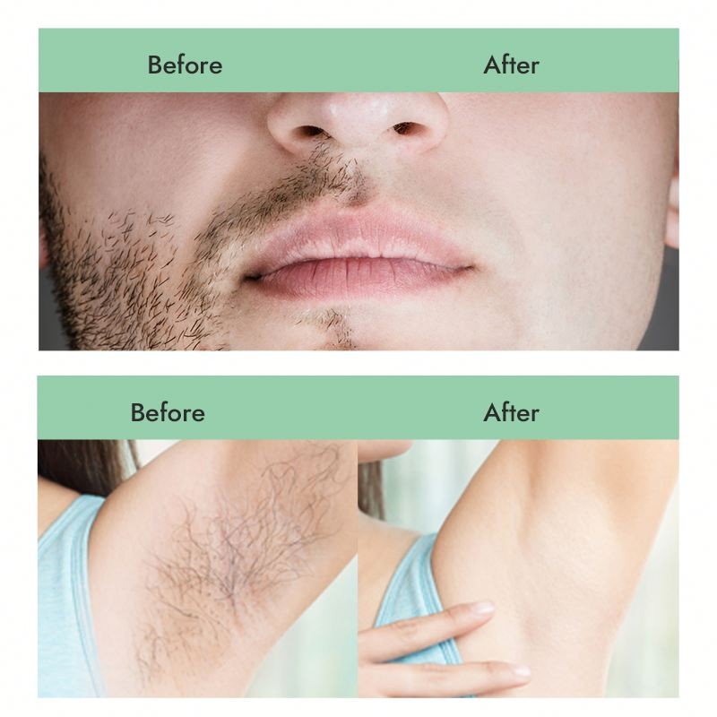 Sugaring Paste Kit Manufacturer - Best Selling 300g Soft Professional Painless