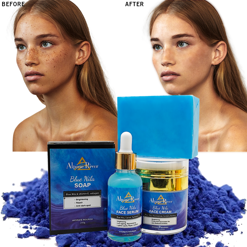 OEM Wholesale Korea Skin Beauty Products Vitamin C Turmeric Remove Dark Spots Skin Nourishing Face Cream Facial Skin Care Set