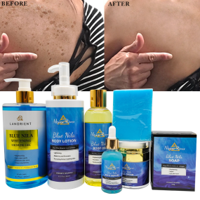 Korean Skin Care Beauty Product Organic Vitamin E Turmeric Remove Dark Spots Moisturizing Skin Whitening NILA Skin Care Set