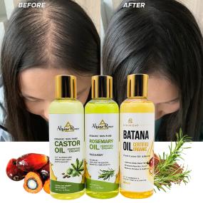Private Label Organic Vitamin E Scalp Care Products Rosemary Hair Nourishing Moisturizing Batana Hair Growth Oil for Women