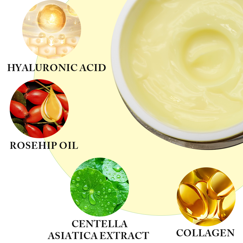 Private Label Natural Organic Body Care Products Vitamin E Rose Hip Oil Stretch Mark Removal Cream for Women