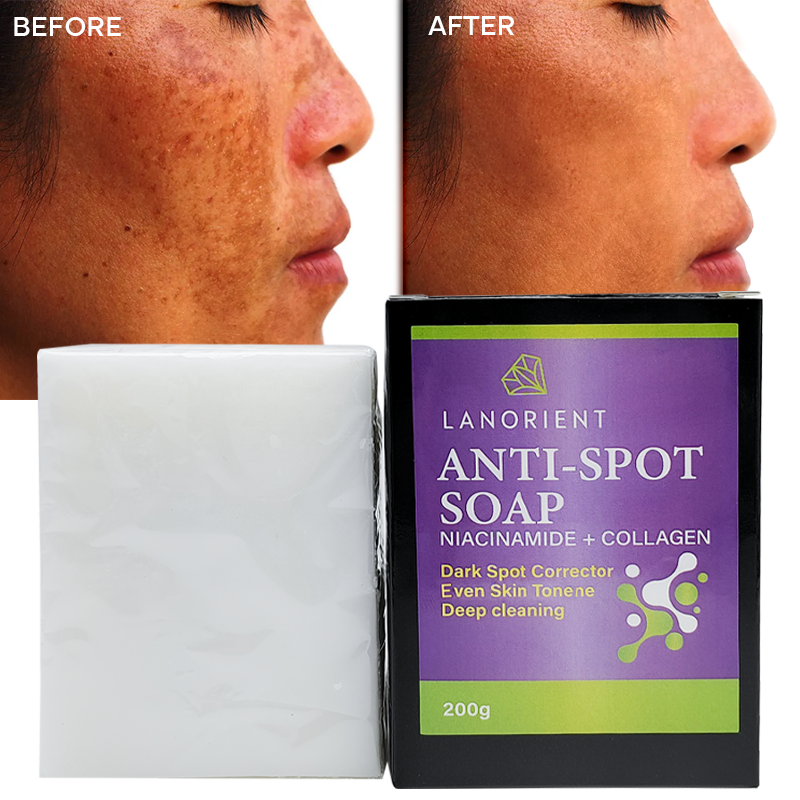 Private Label Organic Body Bath Product Vitamin E Dark Spot Removal Deep Skin Cleansing Exfoliation Nicotinamide Handmade Soap