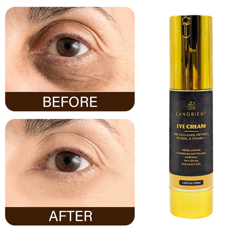 OEM Wholesale Organic Vitamin C Skin Beauty Products Korea Eye Bag Removal Cream Retinol Anti-Aging Eye Cream for All Skin Types