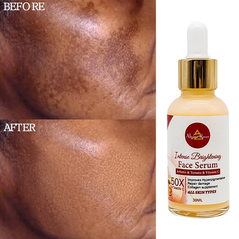 Private Label Vitamin C Korean Skin Whitening and Dark Spot Removal Arbutin Tomato Skin Care Serum for Women