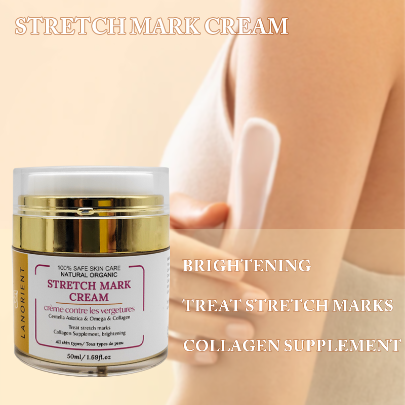 Private Label Natural Organic Body Care Products Vitamin E Rose Hip Oil Stretch Mark Removal Cream for Women