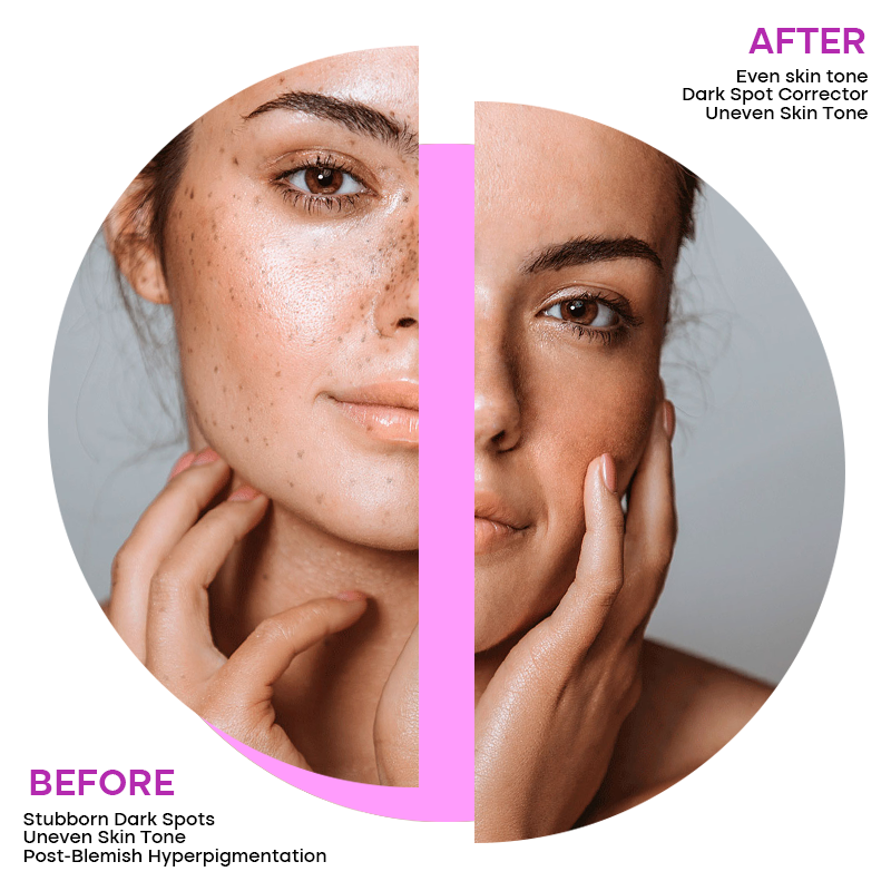 Private Label Organic Body Bath Product Vitamin E Dark Spot Removal Deep Skin Cleansing Exfoliation Nicotinamide Handmade Soap