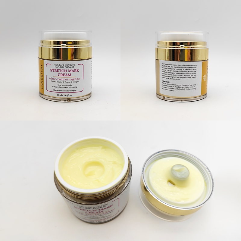 Private Label Natural Organic Body Care Products Vitamin E Rose Hip Oil Stretch Mark Removal Cream for Women