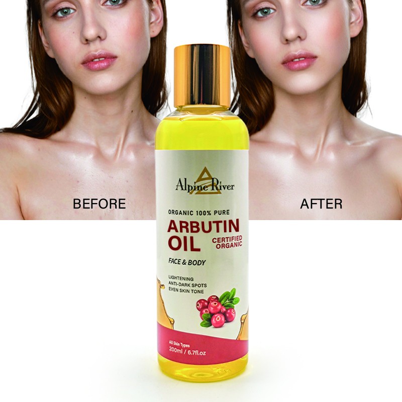 Private Label Vitamin C Skin Whitening and Moisturizing Oil Body Massage Dark Spot Removal Arbutin Oil for All Skin Types