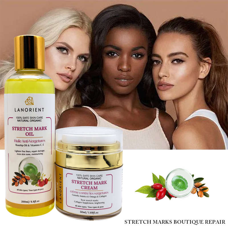 100% Pure Natural Herbal Body Care Products Organic Vitamin E Stretch Mark Removal Restore Skin Elasticity Stretch Mark Cream