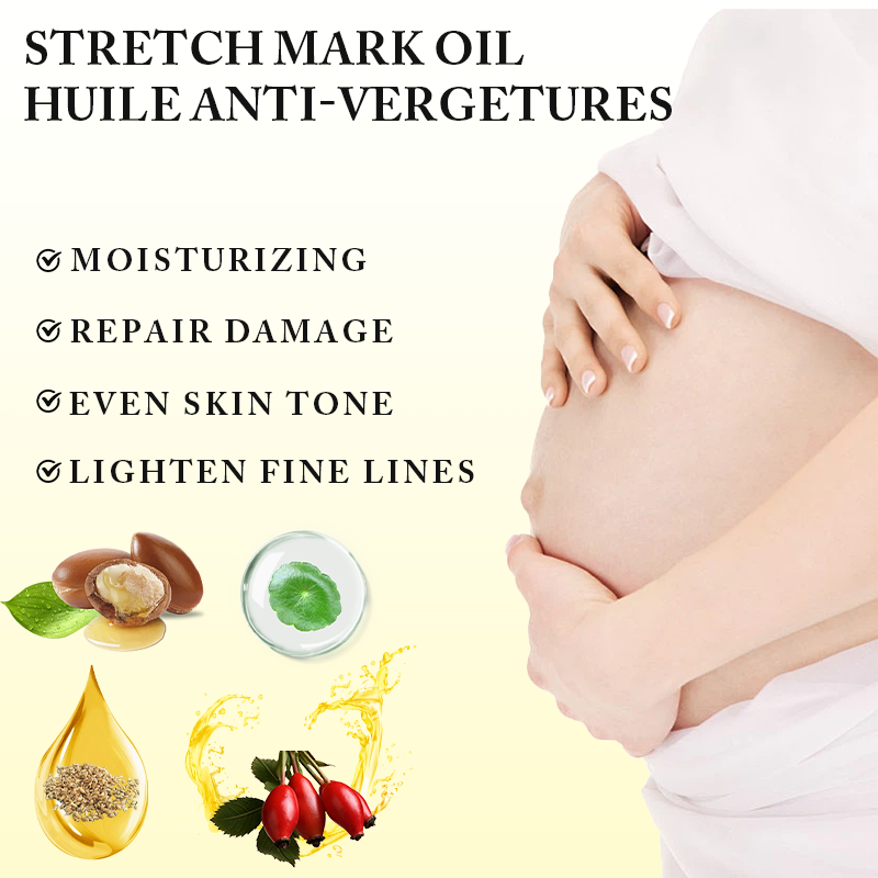 Private Label Natural Organic Vitamin C Skin Revitalizing Stretch Mark Removal Oil Skin Moisturizing Stretch Mark Oil for Women