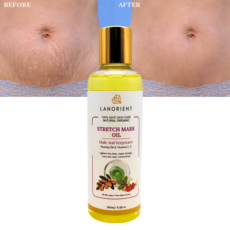 100% Natural Organic Vitamin E Skin Care to Remove Stretch Marks Skin Revitalizing Body Massage Oil for Women