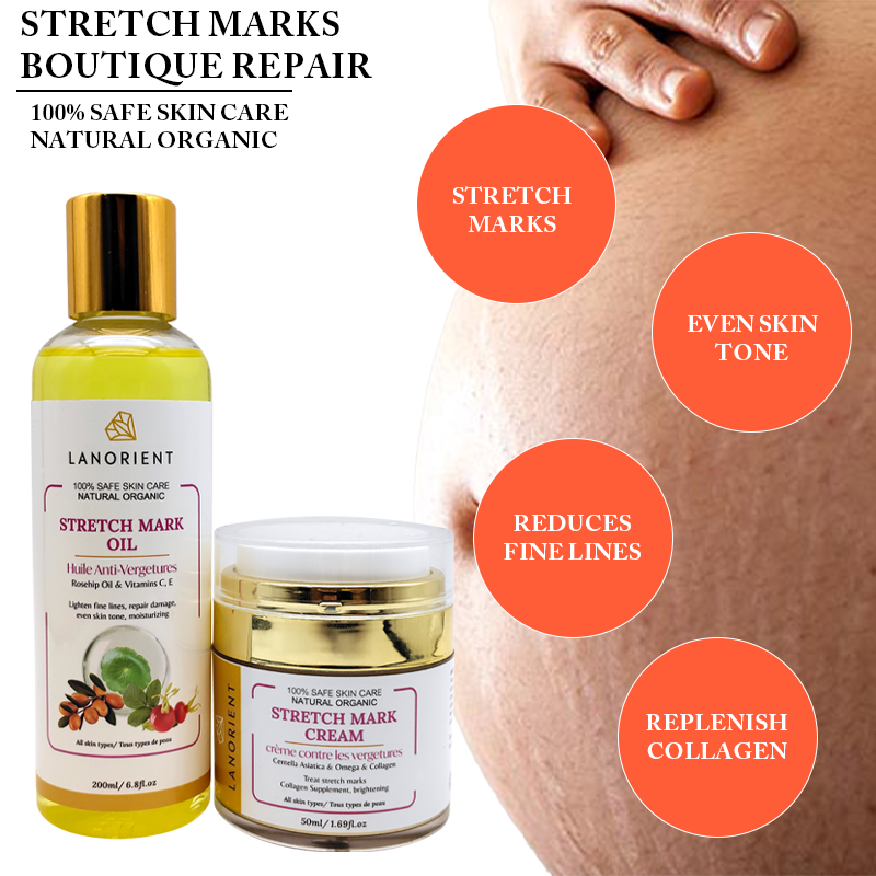 100% Pure Natural Herbal Body Care Products Organic Vitamin E Stretch Mark Removal Restore Skin Elasticity Stretch Mark Cream