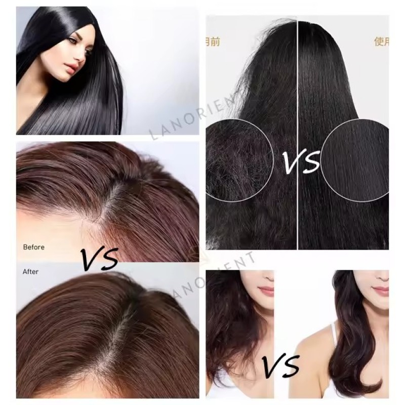 LANORIENT 100% Natural Organic Hair Growth Essential Oil Is Effective for Treating Severe Hair Loss, Suitable for Men and Women