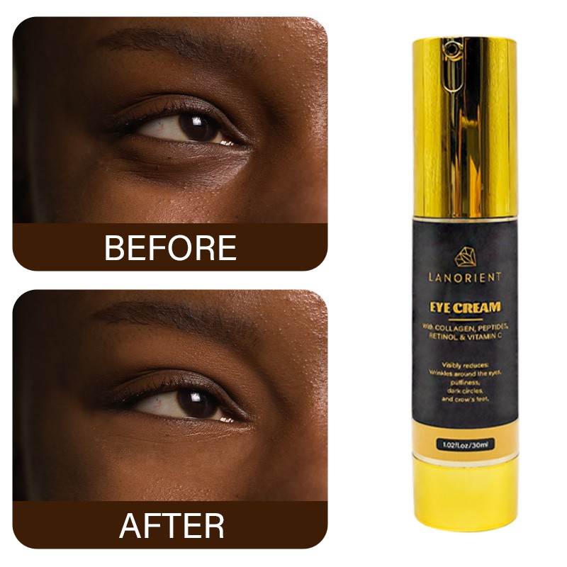 OEM Wholesale Organic Vitamin C Skin Beauty Products Korea Eye Bag Removal Cream Retinol Anti-Aging Eye Cream for All Skin Types